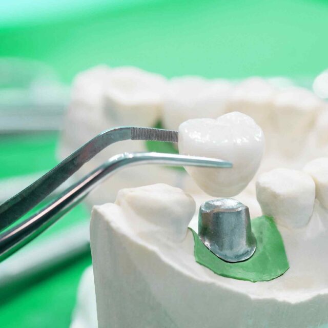 https://dentalspecialist.co/wp-content/uploads/2020/01/post-28-640x640.jpg